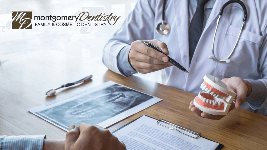 Commonly Asked Dental Questions - Montgomery Dentistry